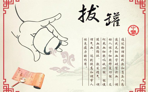 桂林传统拔罐